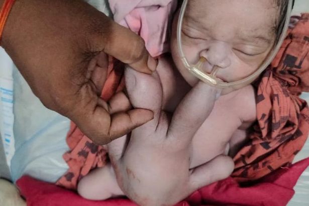 यूपी के हरदोई में चार हाथ और चार पैर का जन्मा अनोखा बच्चा, लोगो की उमड़ी भीड़, कहा भगवान के अवतार ने लिया जन्म
