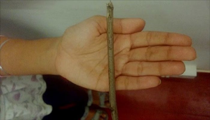 बच्चों को लोहे की रॉड से पीटने का लगा महिला टीचर पर आरोप , 30 बच्चों के घायल होने के बाद अभिवावकों का स्कूल में हंगामा।