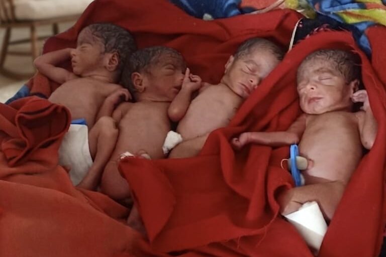 एक साथ महिला ने दिया 4 बच्चों को जन्म ,बुलढाणा के आदिवासी बहुल गांव चारबन में दुर्लभ घटना, बिना मेडिकल सुविधा के घर पर हुआ प्रसव