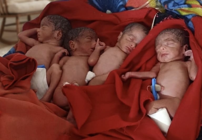 एक साथ महिला ने दिया 4 बच्चों को जन्म ,बुलढाणा के आदिवासी बहुल गांव चारबन में दुर्लभ घटना, बिना मेडिकल सुविधा के घर पर हुआ प्रसव