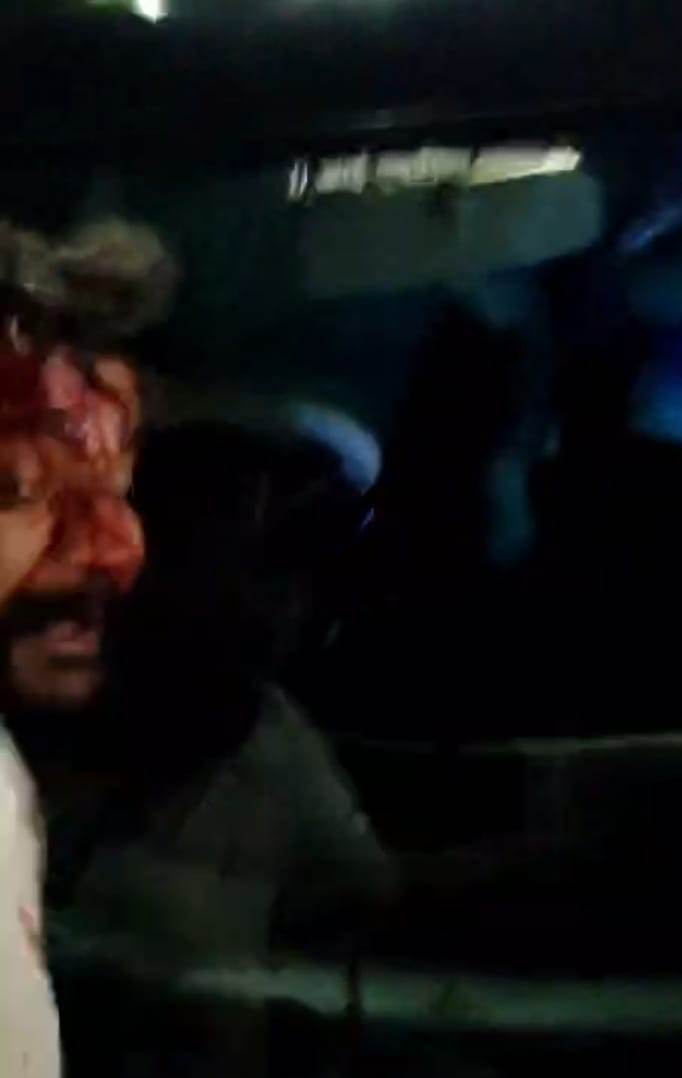 Navi Mumbai Road Rage Horror - नवी मुंबई में रोड रेज की खौफनाक वारदात  रॉड से हमला कर ओला चालक को बोनट पर 2 किलोमीटर तक घसीटा